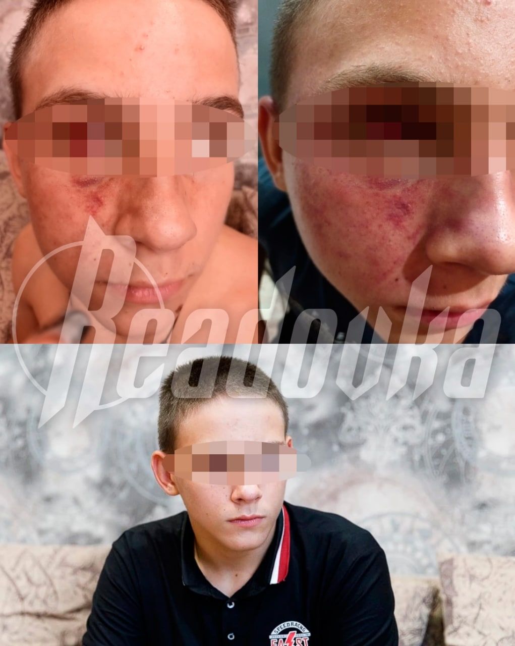 Двое полицейских жестоко избили 14-летнего подростка в Волгограде, приняв его за закладчика