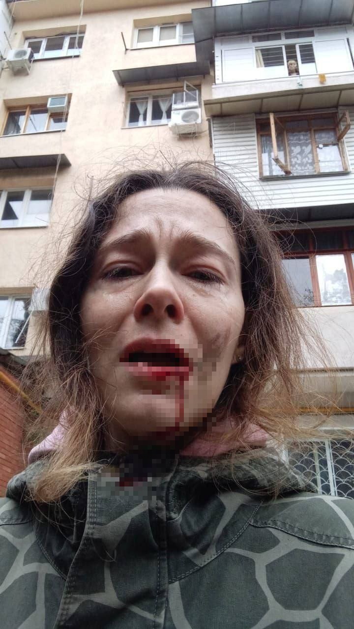 В Сочи пенсионер ударил палкой по лицу хозяйку французского бульдога