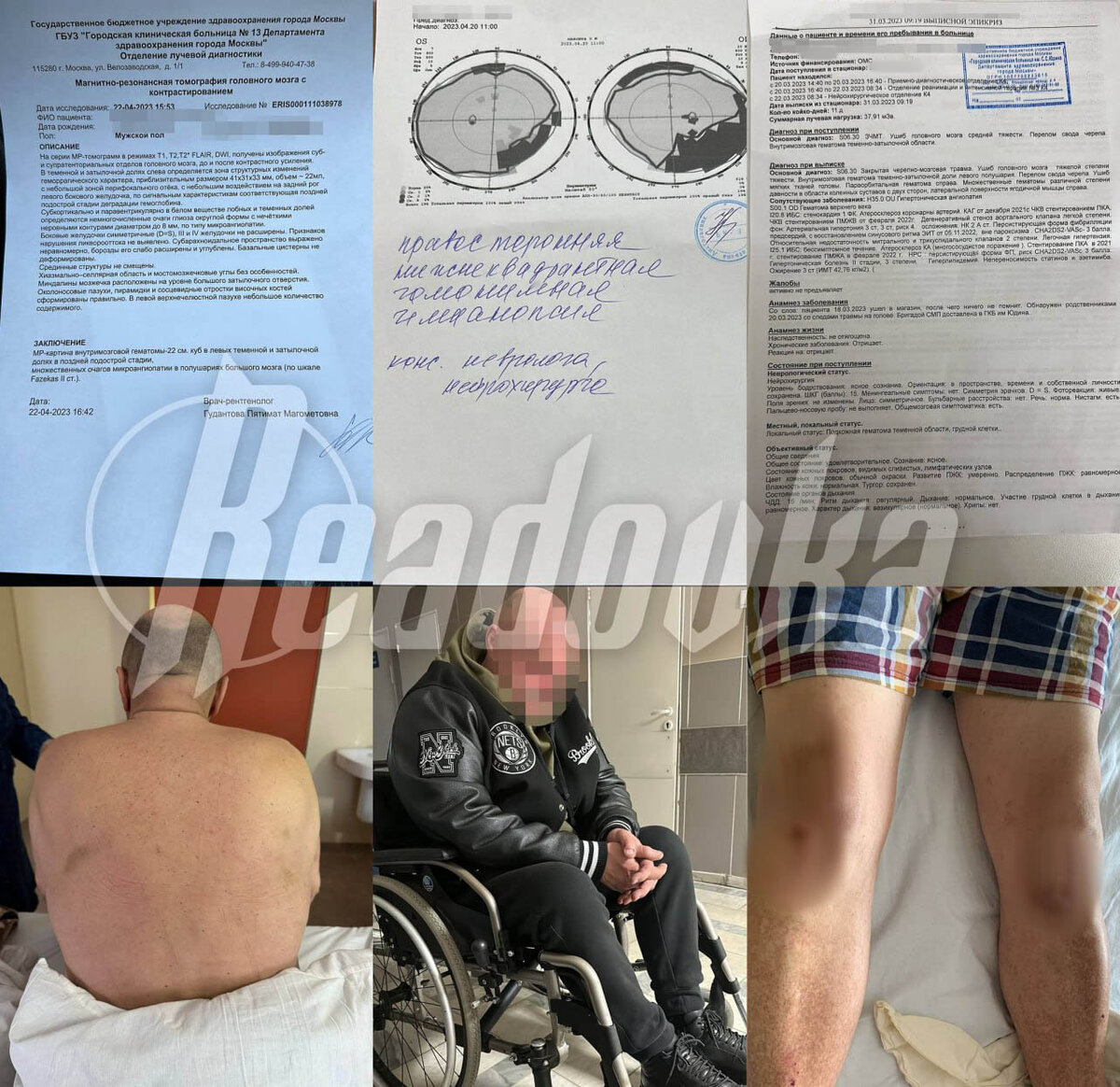 Полицейские задержали мужчину в московском метро, думая, что он был пьян