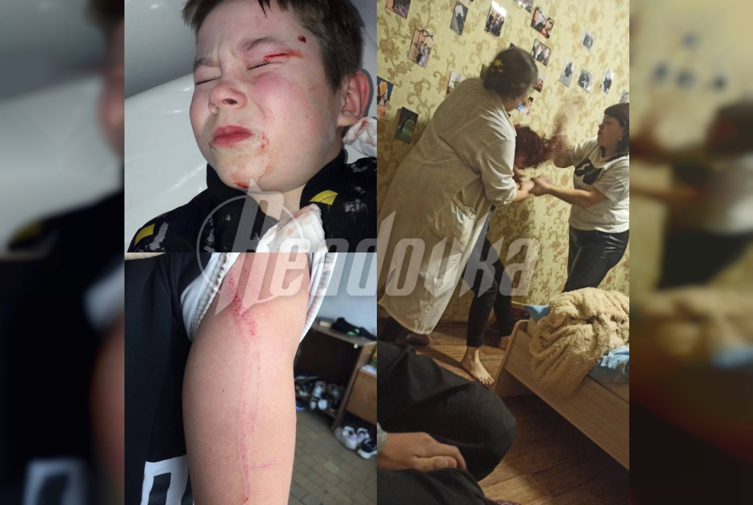 В Свердловской области сотрудники детского дома избивают детей и крадут их вещи