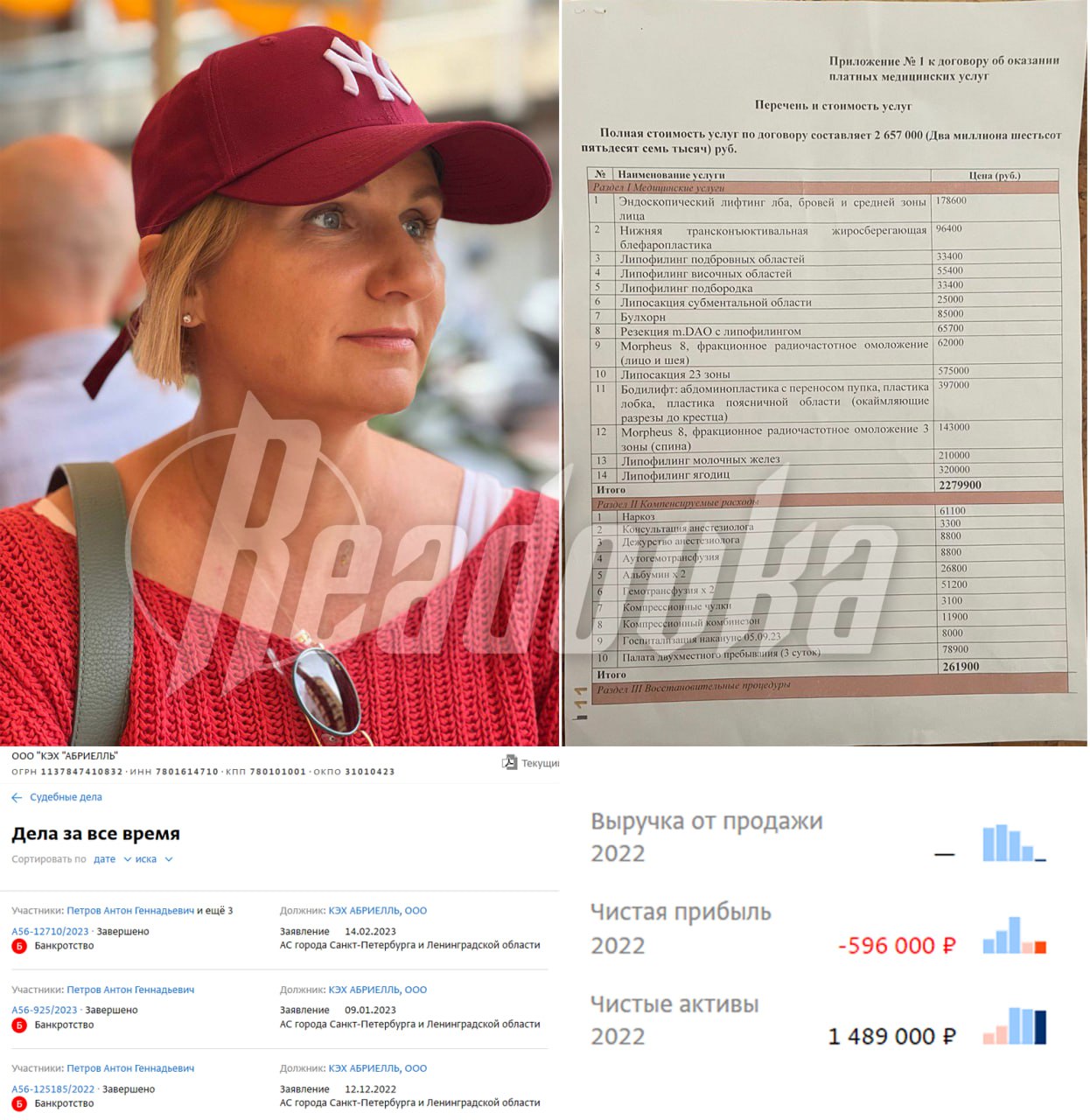 «Ее положили под кислородик»: в Петербурге женщина умерла после 30 пластических операций, на которые ее развели