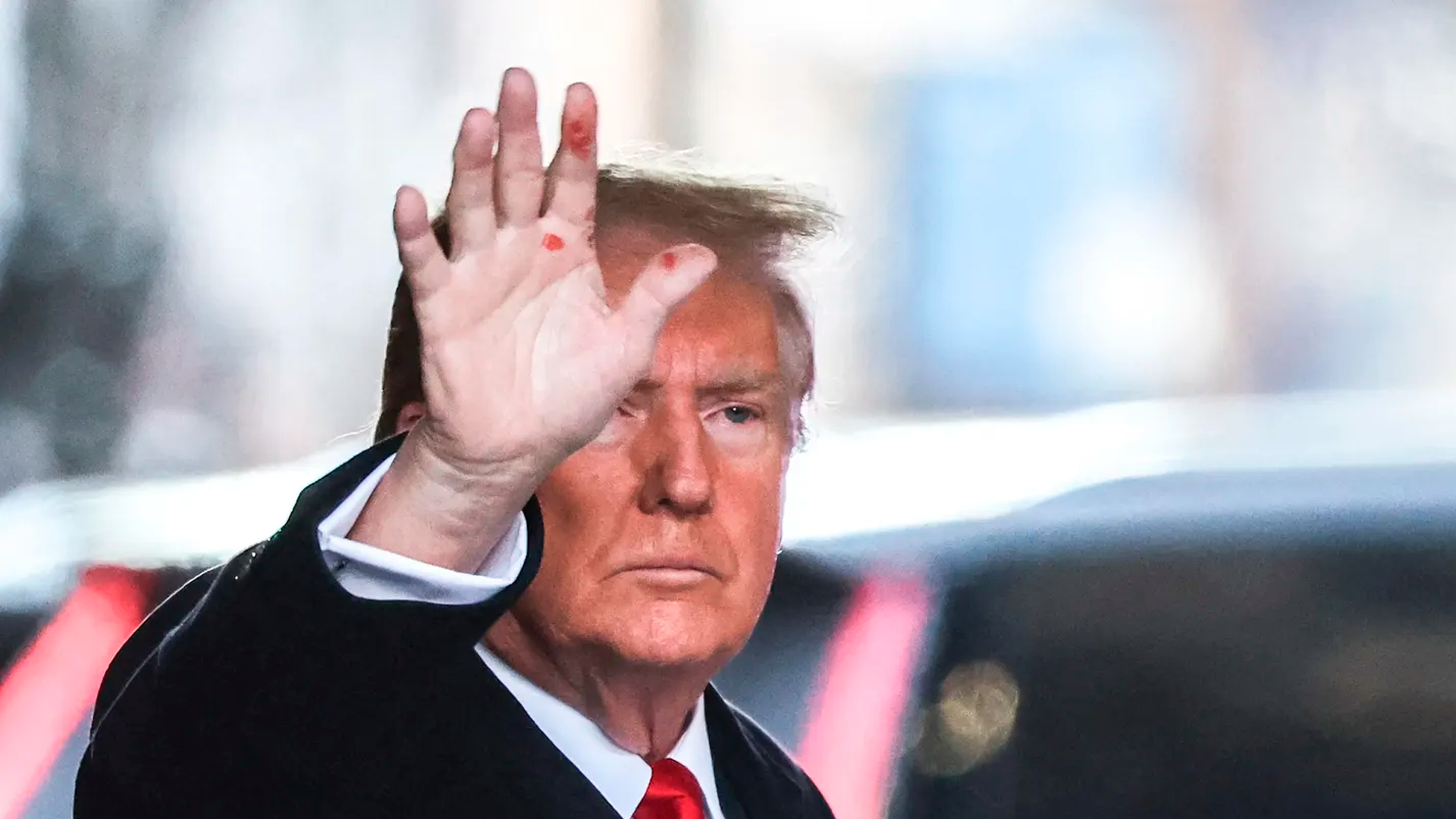 Трамп объяснил фото с красными пятнами на ладони