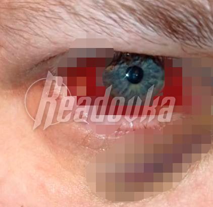 В Балашихе банда агрессивных подростков избила мужчин, 18+