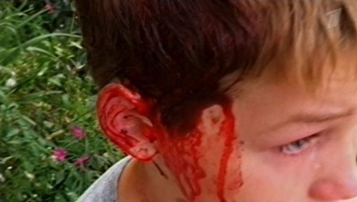 Шок! Школьники изнасиловали мальчика-сироту и сожгли ему гениталии