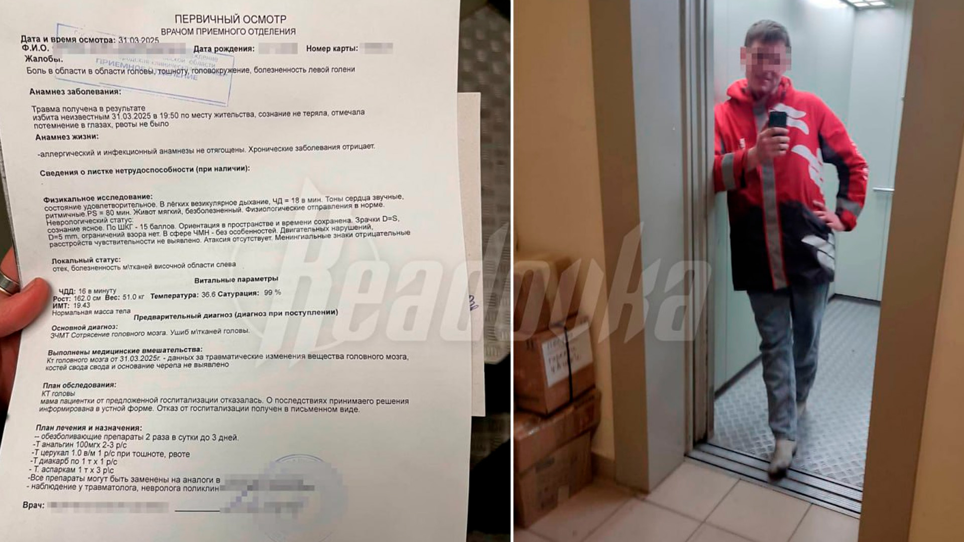 В Подмосковье мужчина избил волонтера и ее племянницу за помощь фронту