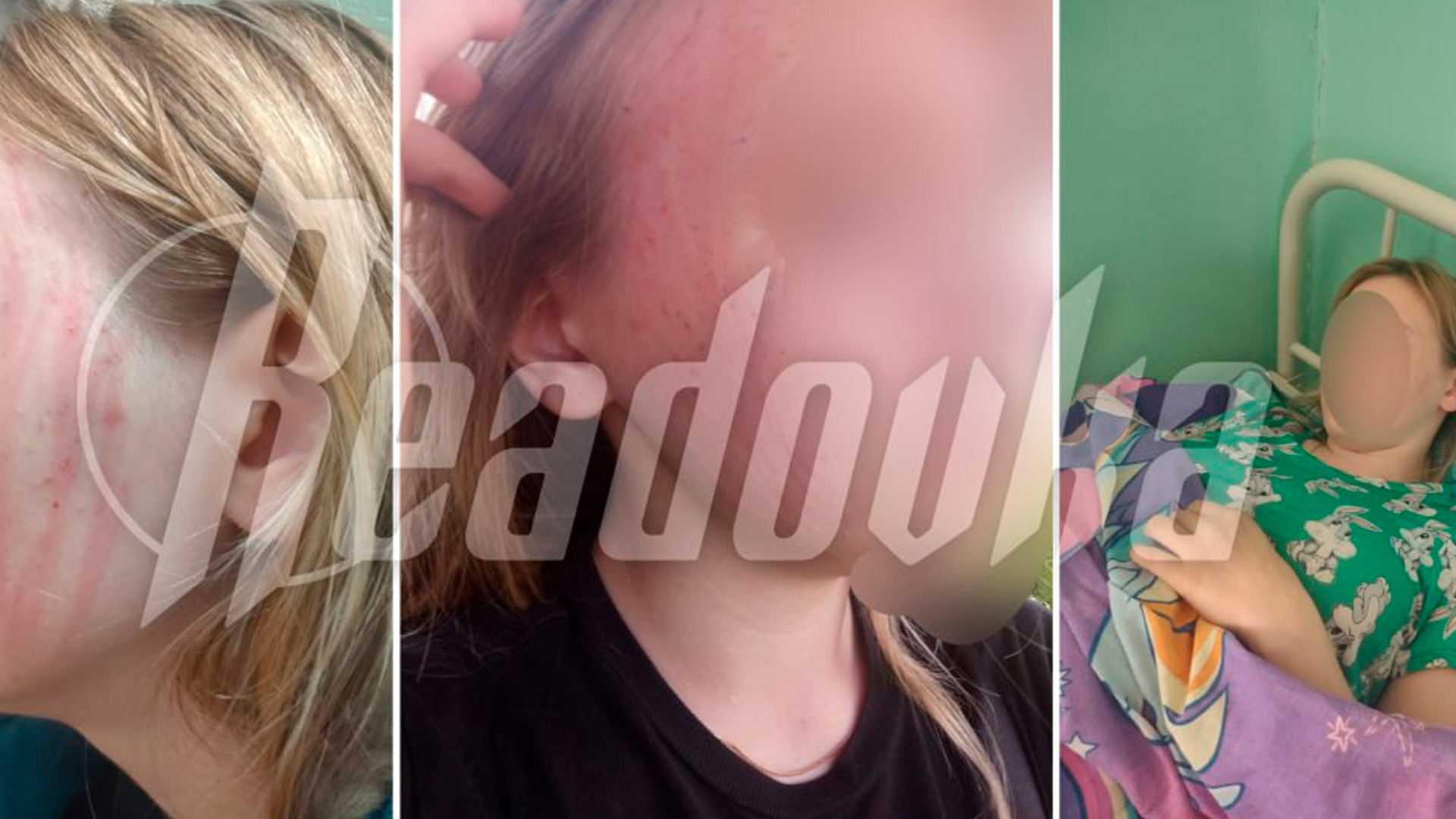 Во Ржеве водитель автобуса избил девочку за то, что она не смогла доказать оплату проезду