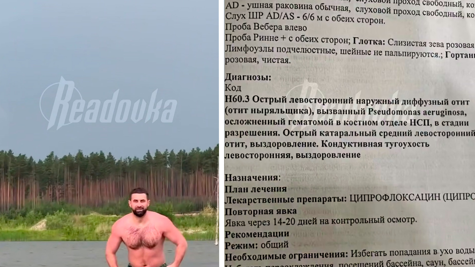 Парень из Томска решил искупаться в местной речке и подхватил редкого паразита