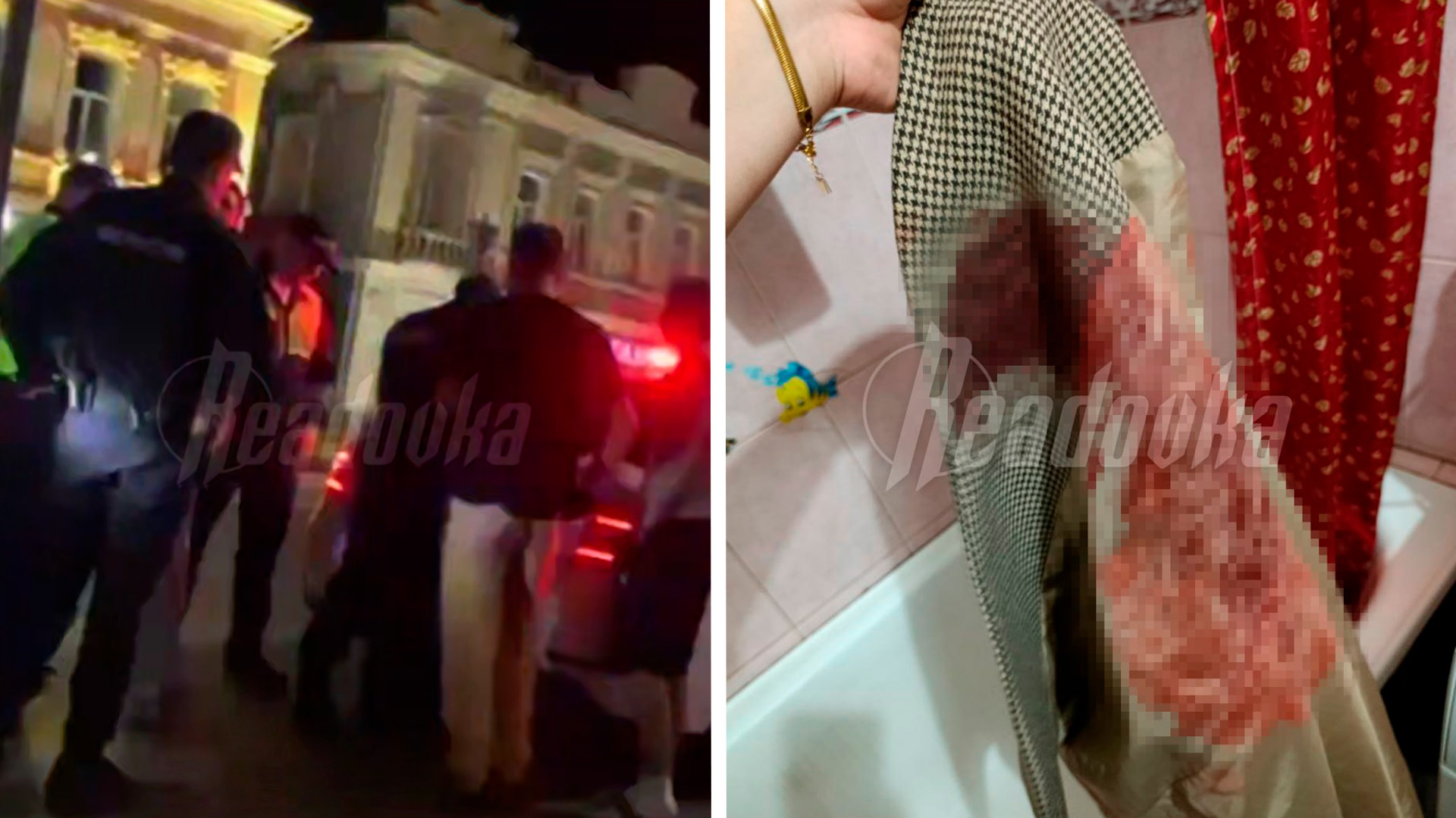В Омске мигрант пырнул ножом русского парня, вступившегося за девушку