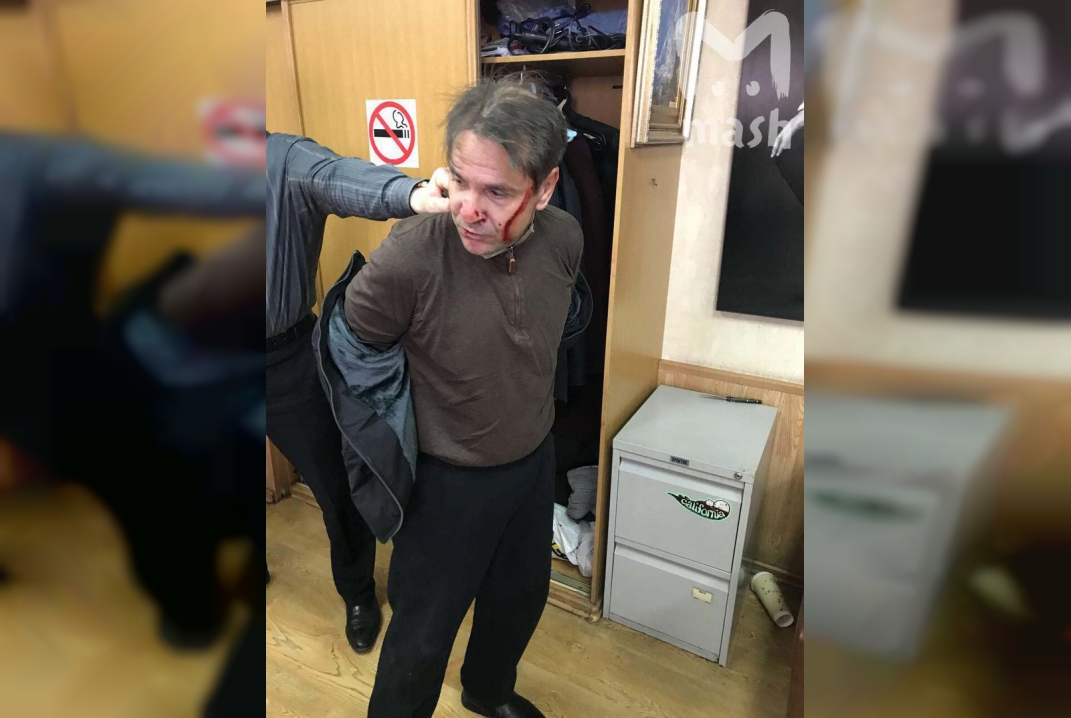 Мужчина средних лет с ножом напал на журналиста