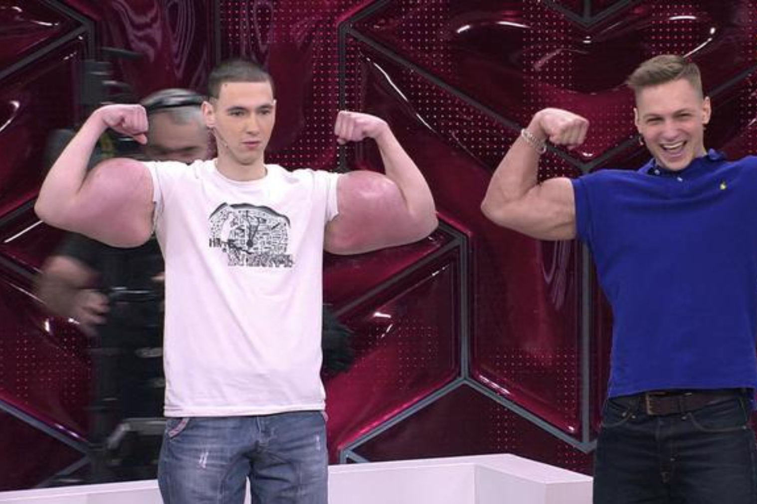 Синтоловый качок может остаться без двух рук