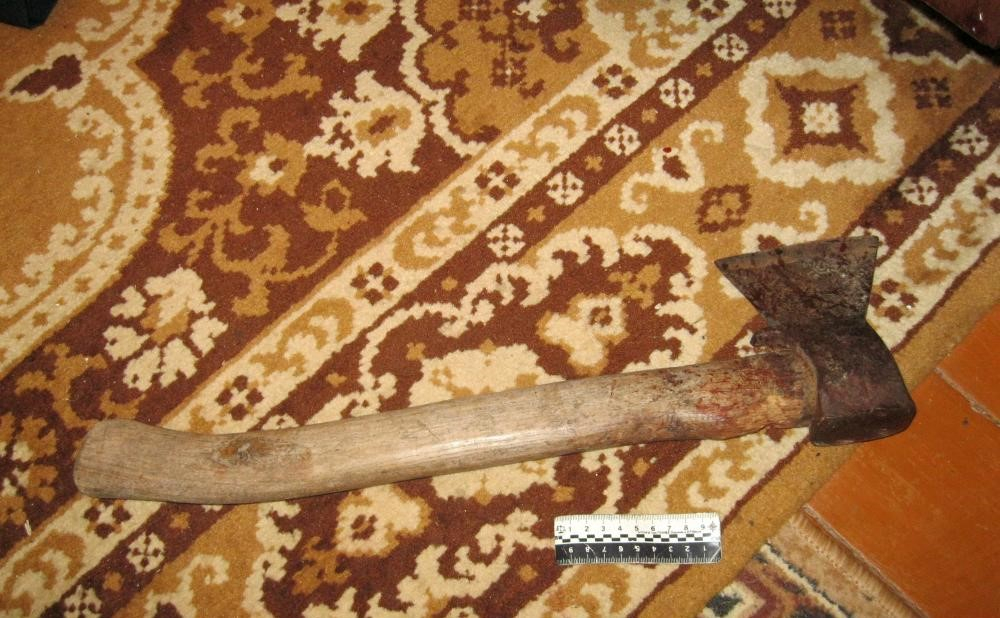 Родная мать изрубила лицо сына топором