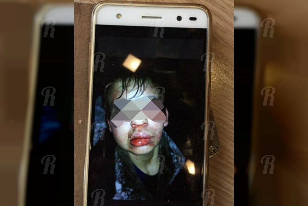 «Я б тебя вообще убил, б***ь!». Подростки практически до смерти избили школьника