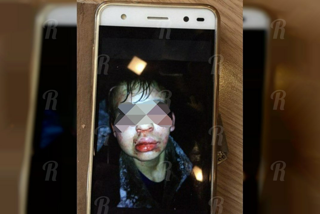«Я его била ногами по лицу!». Признание 9-классницы, которая избила мальчика-инвалида