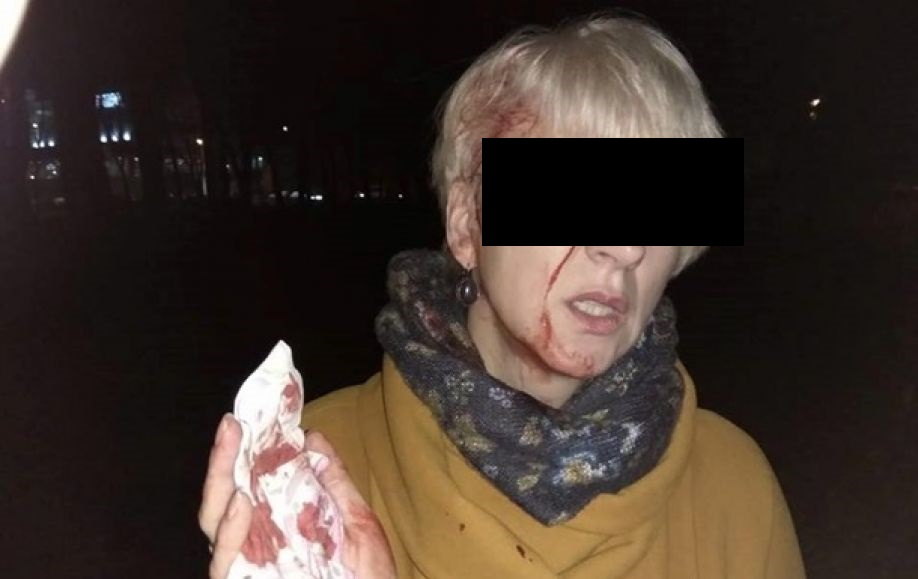 Не теряла сознания только чудом. Мужчина избил подругу кочергой, а после насиловал