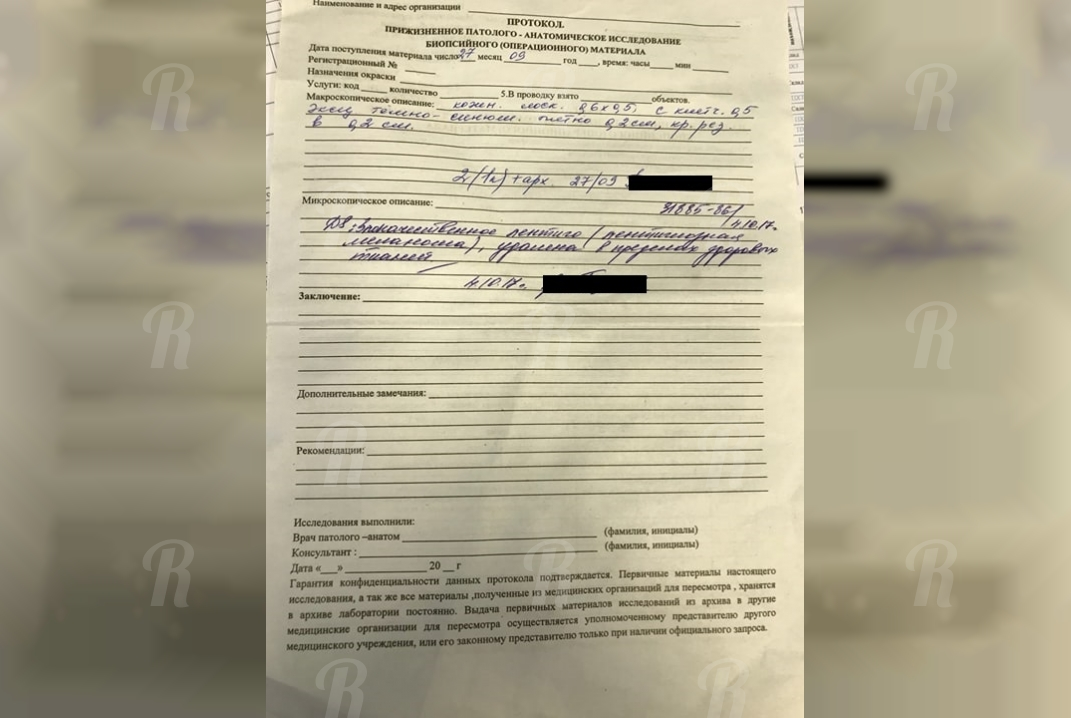 По ошибке вырезали