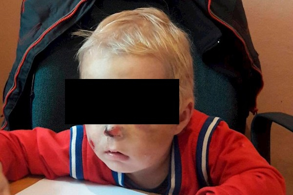 В Волгограде многодетная мать морила голодом и избивала 2-летнего сына