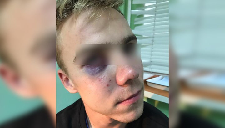 Прохожий избил подростка-инвалида, который попросил о помощи