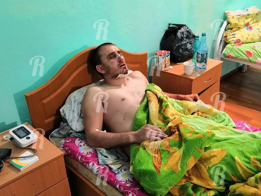Мужчину из Алтая изуродовали из-за авто с преступным прошлым