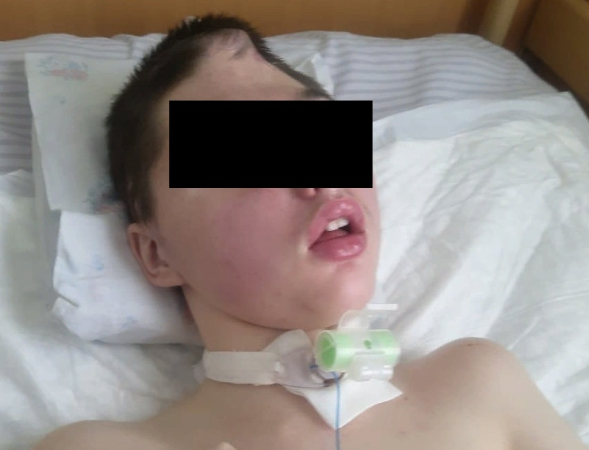 Умер мальчик, который пострадал, спасая мать-предательницу