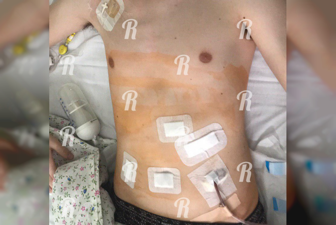 «У одного суворовца нашли очаг в голове, его ждет трепанация черепа»