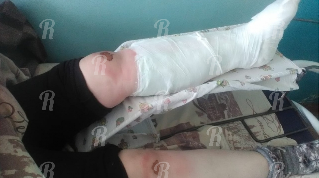 Омской пенсионерке со сломанной ногой пришлось ползти до дома 9 километров