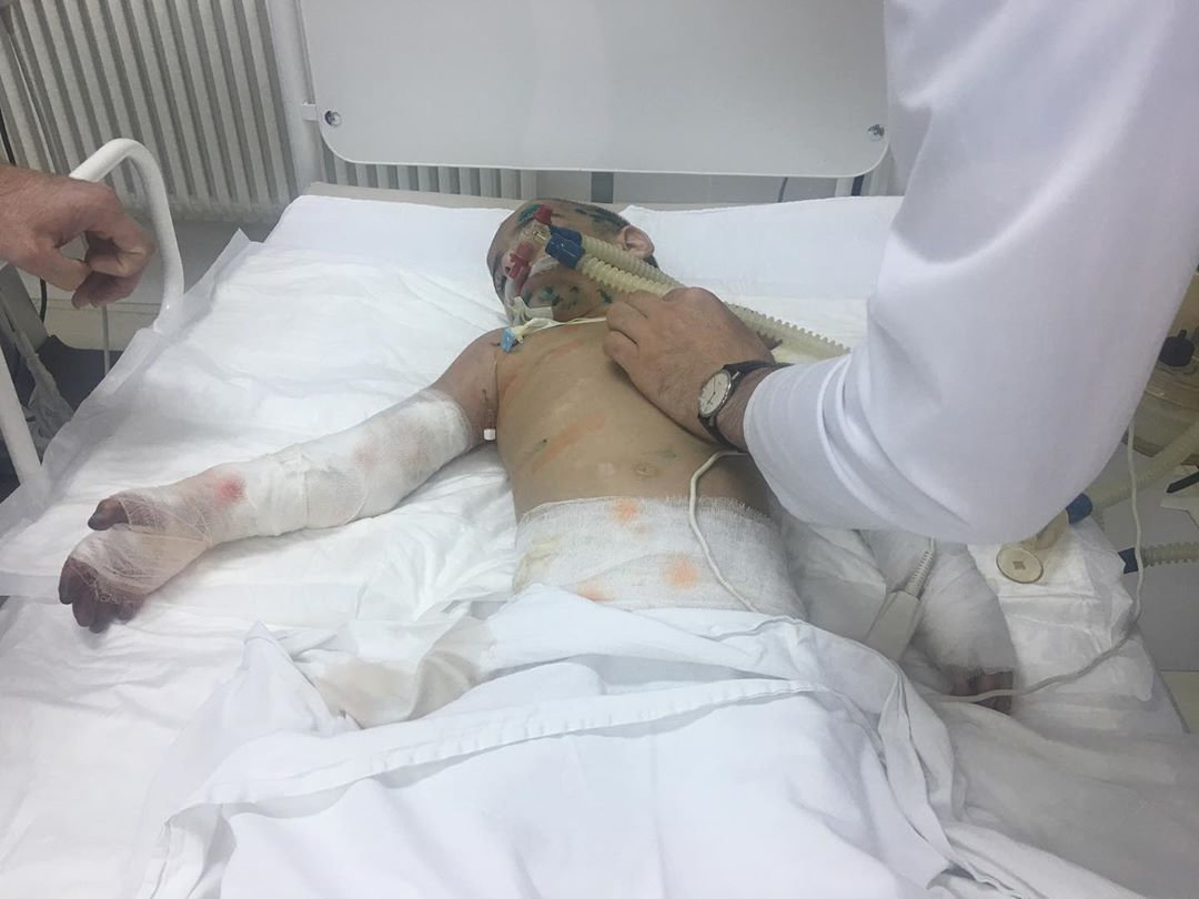 Суд арестовал тетю избитой 7-летней девочки из Ингушетии