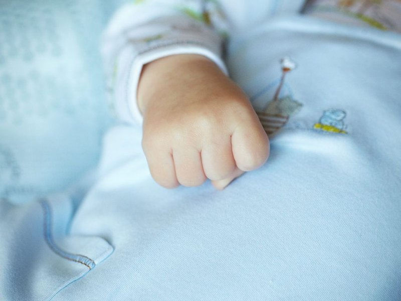 В Португалии родился малыш без лица