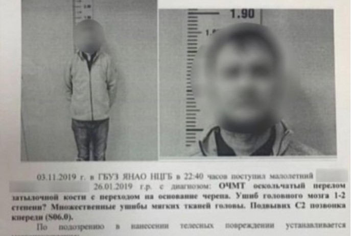 Россиянин проломил череп грудничку, чтобы тот не плакал, и попытался скрыться
