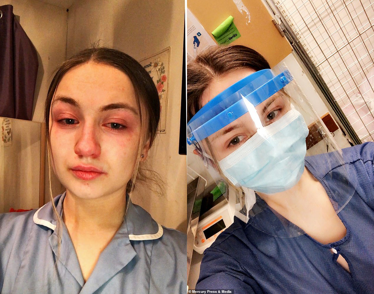 Медсестра, работающая по 13 часов в сутки, рассказала о страхах врачей за больных