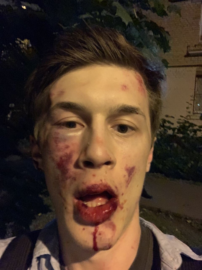 В Москве избили Егора Жукова