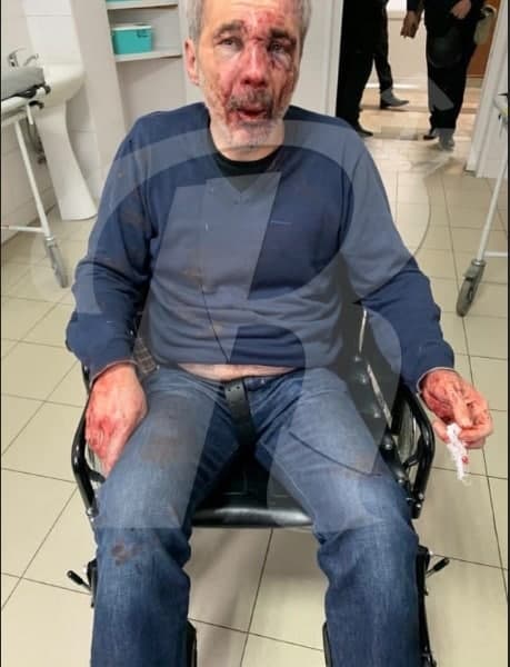 У пострадавшего учителя из Нальчика был с собой солидный револьвер