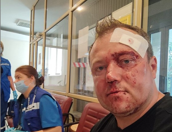 Глава союза десантников избил красноярского блогера Дмитрия Полушина