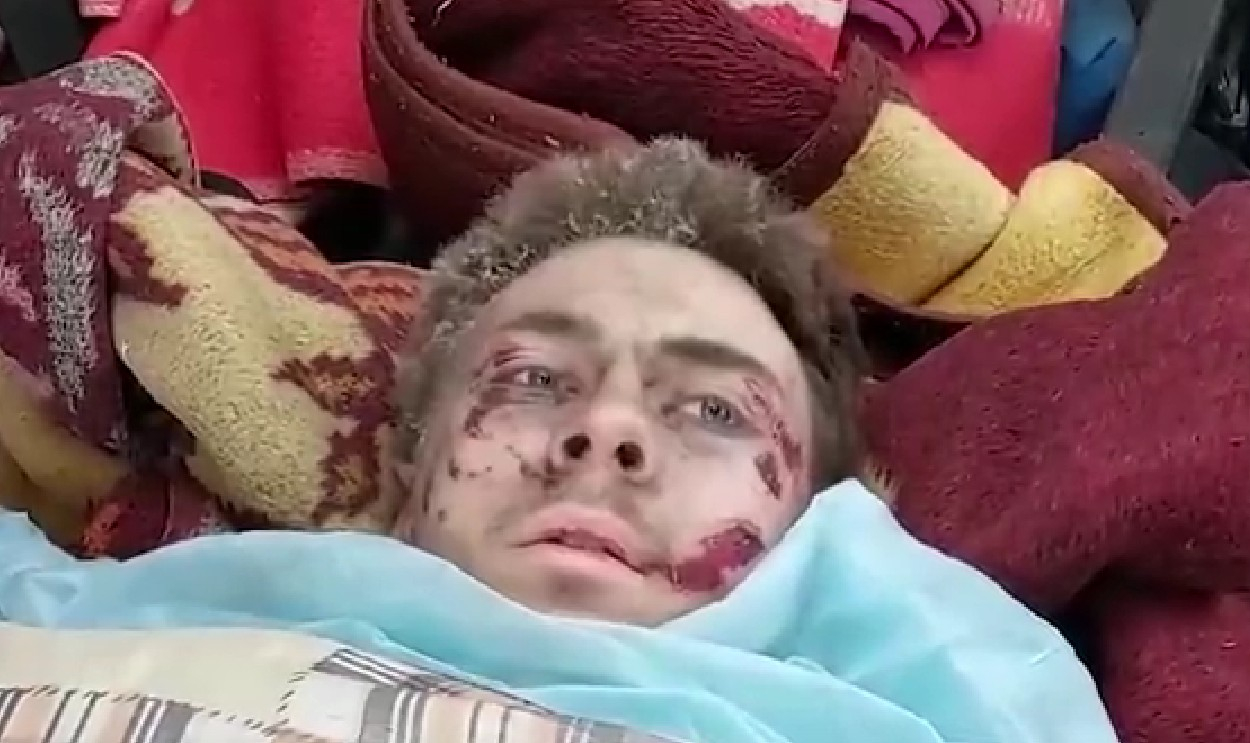 Одним из выживших пассажиров сбитого украинского вертолета оказался боец нацбата «Азов»