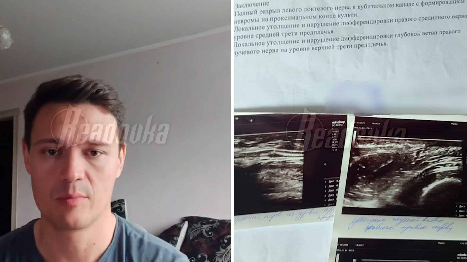 Ветерана СВО из Хакасии не признали инвалидом, чтобы сэкономить