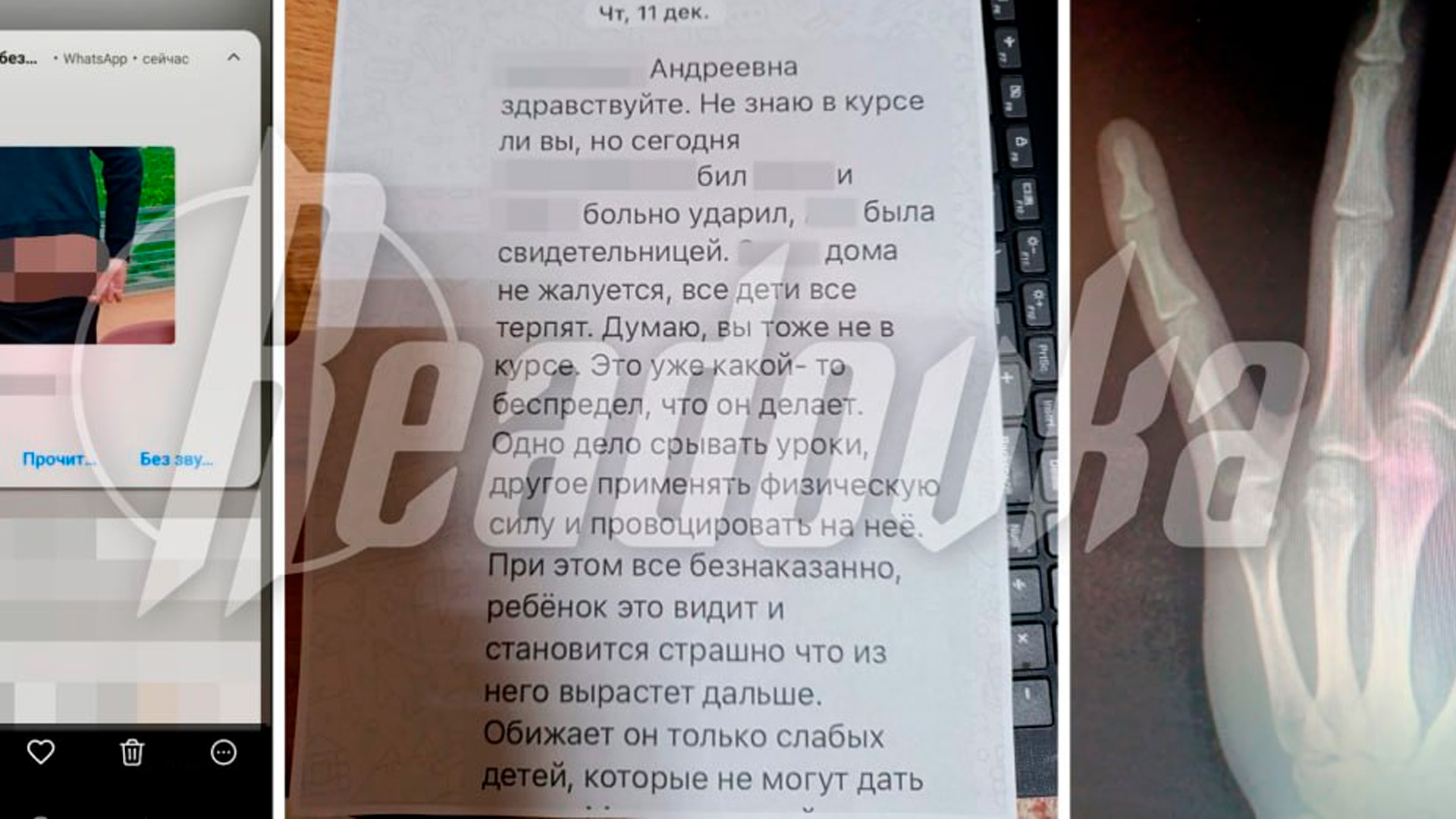 Родители пожаловались на мальчика с ОВЗ, державшего в страху всю школу в Серпухове