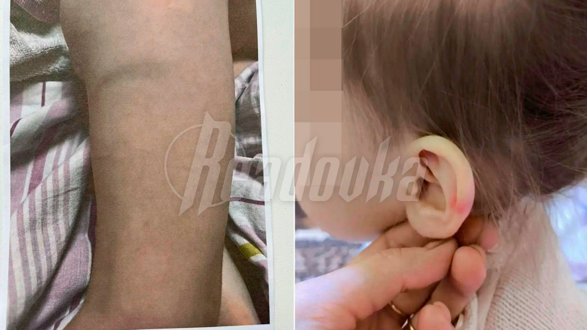 В Угличе родители намерены добиться отстранения воспитательницы из-за жалоб на жестокое обращение с детьми